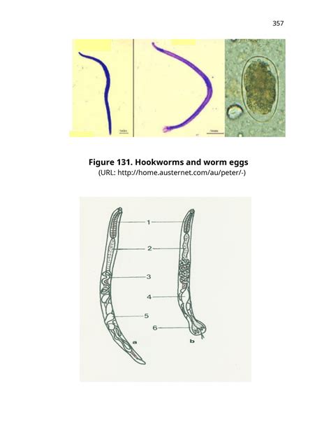 Medical Symptoms And Diagnosis 57 63 Figure 131 Hookworms And Worm