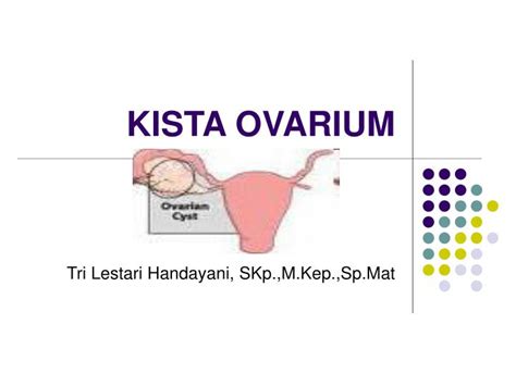 Ppt Kista Ovarium Powerpoint Presentation Free Download Id901683