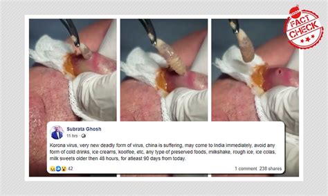 Chakravarthy ondu malebillu video song. Corona Virus Effects | Overall health Information ...