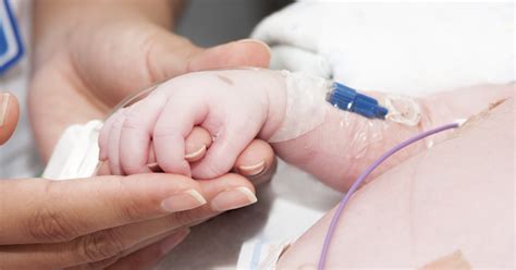 About Premature Baby Development Livestrongcom