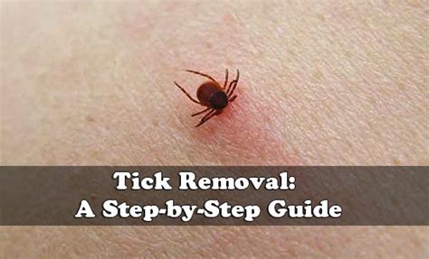 The Correct Way To Remove A Tick