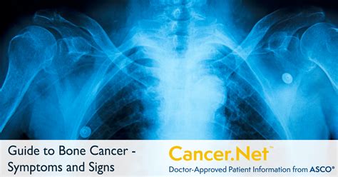 Bone Cancer Symptoms And Signs Cancernet