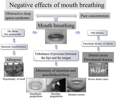 E Negative Effects Of Mouth Breathing Download Scientific Diagram