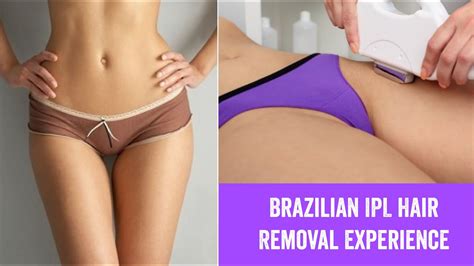 my brazilian ipl hair removal experience youtube