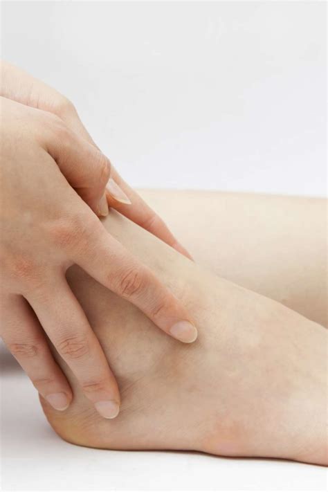 Itchy Ankles Causes Rash And Treatment