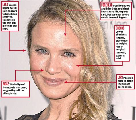 These Are The Areas Some People Believe Renee Zellweger Got Fixed