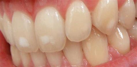 White Spots Partners In Dental Care