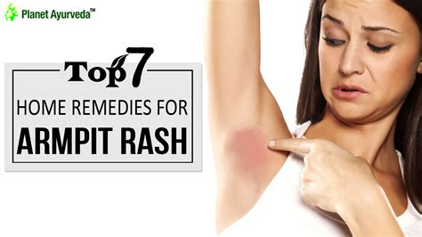 Armpit Yeast Infection Symptoms Causes Prevention Tips