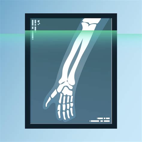 Premium Vector Vector Of Human Bones Skeleton And Joints On X Ray