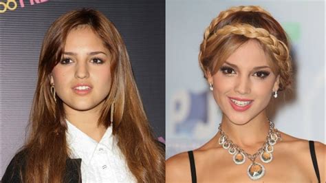 22 Eiza Gonzalez Before And After Surgery Pics