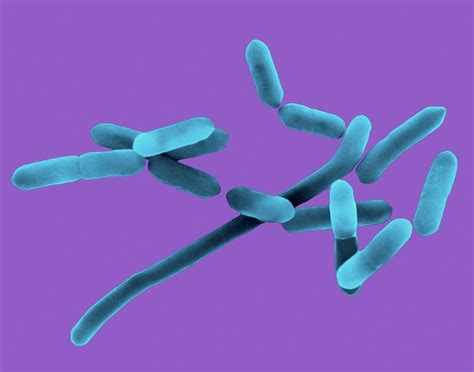 Listeria monocytogenes is a bacterium infectious to humans and causes the illness listeriosis. Listeria Monocytogenes Photograph by Dennis Kunkel ...