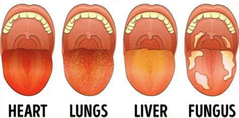 What Your Tongue Is Trying To Tell You About Your Health