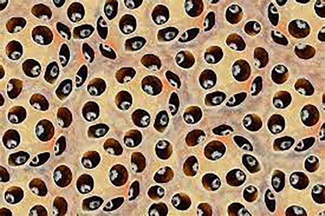 Trypophobia Symptoms Causes And Therapy