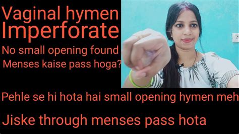 vaginal hymen imperforate hymen youtube