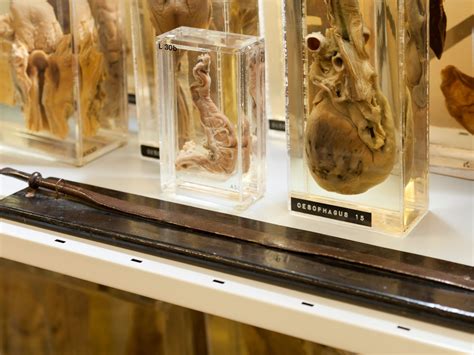 dead good rare opportunity to visit ucl pathology museum ucl news ucl london s global