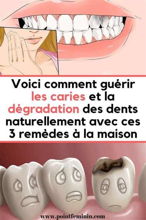 Soigner Naturellement Vos Caries Et La D T Rioration Des Dents Laide