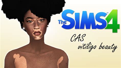 Vitiligo Skin Overlay Sims 4