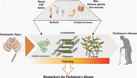 Learn why it's so hard to predict and how its symptoms may change over time. Parkinson's disease biomarkers based on α‐synuclein - Fayyad - 2019 - Journal of Neurochemistry ...