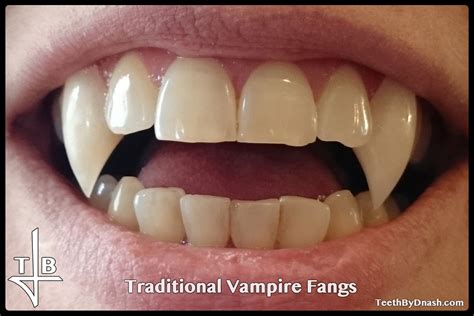 Traditional Vampire Teeth By Dnash