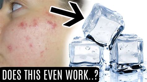 I Tested An Ice Cube On My Face For Weeks These Are The Results Did It Work Youtube