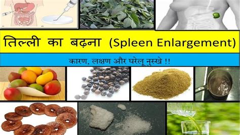 Spleen Enlarged Size What Causes An Enlarged Spleen Swollen Spleen