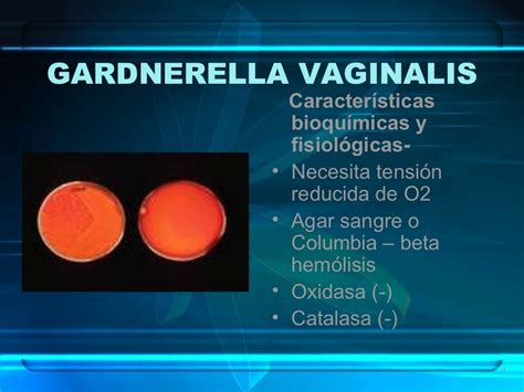 Gardnerella