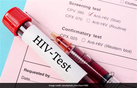 From Symptoms To Transmission Here Are Five Things To Know About Hiv