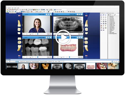 Smart Image Dental Imaging Software Dentrix Canada