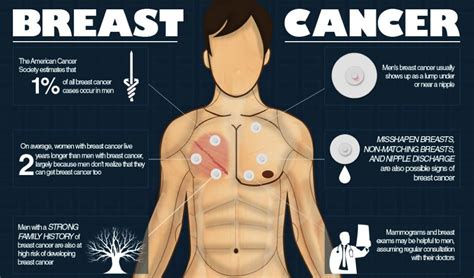 men are also at risk of breast cancer
