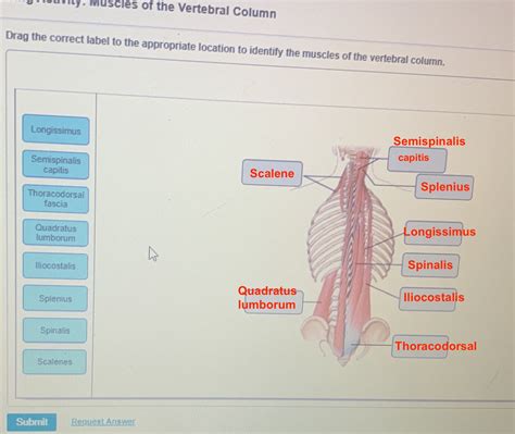 Solved Human Anatomy Les Of The Vertebral Column Drag The Correct
