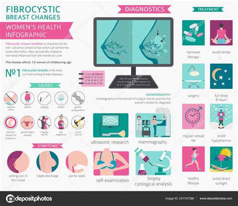 Fibrocystic Breast Changes Disease Medical Infographic Diagnostics