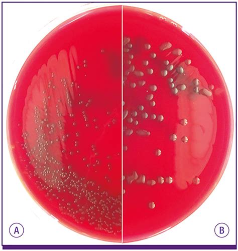 Streptococcus Pneumoniae Colony Morphology