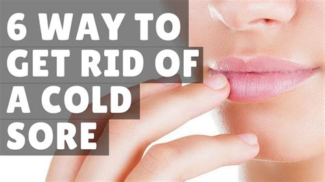 6 Way To Get Rid Of A Cold Sore Home Remedies Fast Overnight Cold