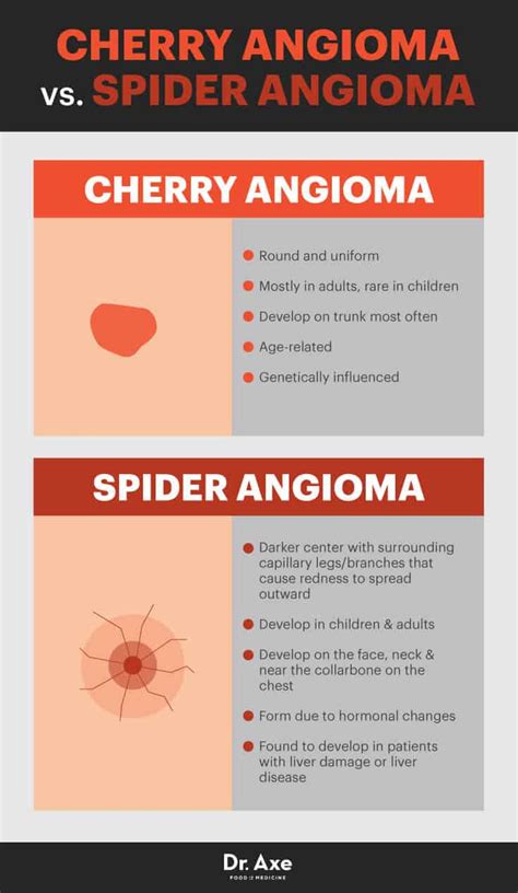 Cherry Angioma Risk Factors Symptoms And Natural Treatments Dr Axe
