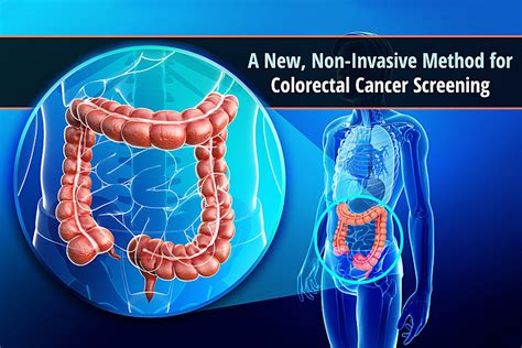 A New Non Invasive Method For Colorectal Cancer Screening