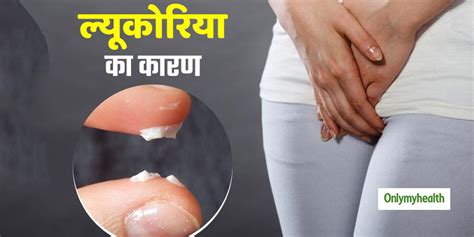 Leukorrhea Causes And Symptoms In Hindi ल्यूकोरिया सफेद पानी क्या