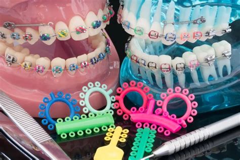 A Guide To Picking The Best Braces Colors Wheel For You Winn Jinn