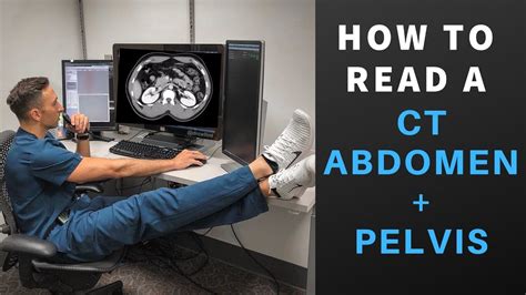 Radiology How To Read A CT Abdomen Pelvis My Search Pattern