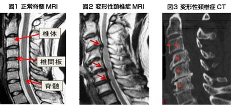札幌麻生脳神経外科病院｜専門外来