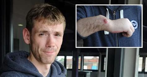 Dad Wants His Own Arm Cut Off After Savage Street Attack By Thugs