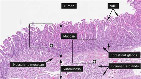Dictionary Normal Duodenum The Human Protein Atlas