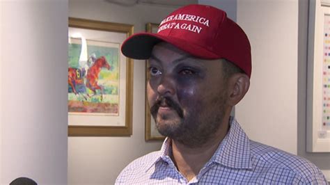 Ny Man Says He Was Beaten For Wearing A Maga Hat