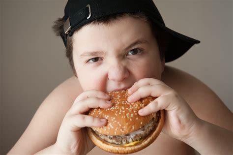 ObesitÀ Infantile Un Problema Dalle Tante Facce Michele Rosa
