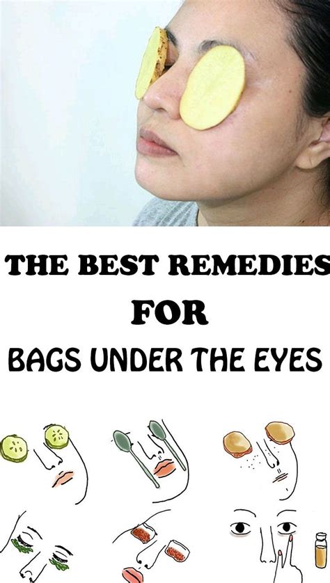 The Best Remedies For Bags Under The Eyes With Images Reduce Eye Bags Puffy Eyes Remedy