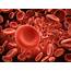 Iron Deficiency Anemia Know In Details About This