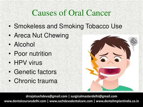 Oral Cancers Squamous Cell Carcinoma Of Oral Cavity