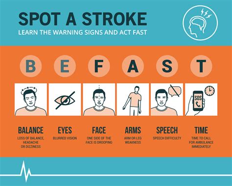 Stroke Emergency Awareness And Recognition Signs Medical Procedure Infographic Ilkley
