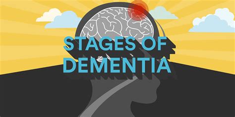 Dementia Stages Chart A Visual Reference Of Charts Chart Master