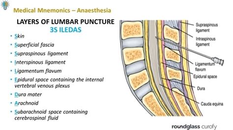 Layers Of Lumbar Puncture