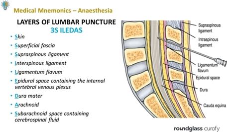 Lumbar Puncture Anatomy Layers